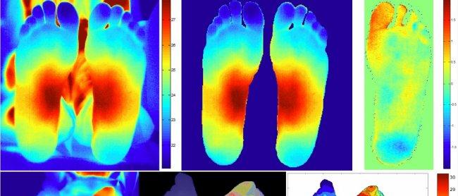 Tecnología astrofísica aplicada a la Medicina